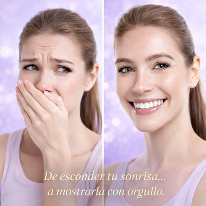 BLANQUEADOR DENTAL. ÚLTIMA TENDENCIA "RECUPERA LA CONFIANZA AL SONREIR"